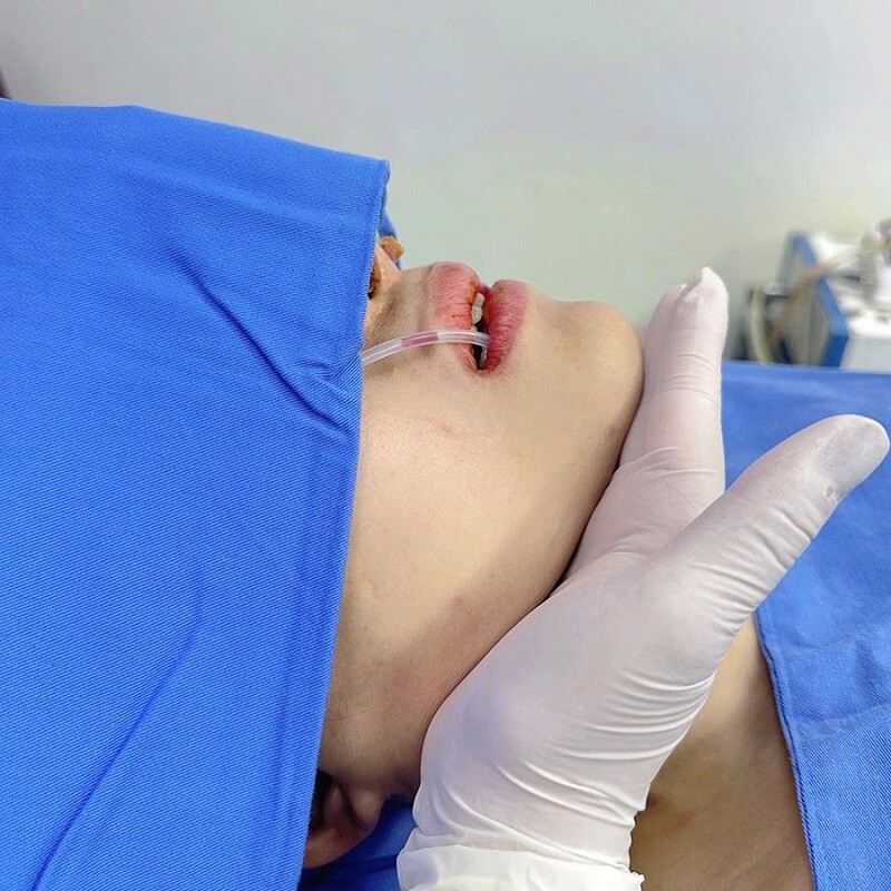 Quá trình chỉnh hàm khiến nhiều người lo lắng sẽ gây đau