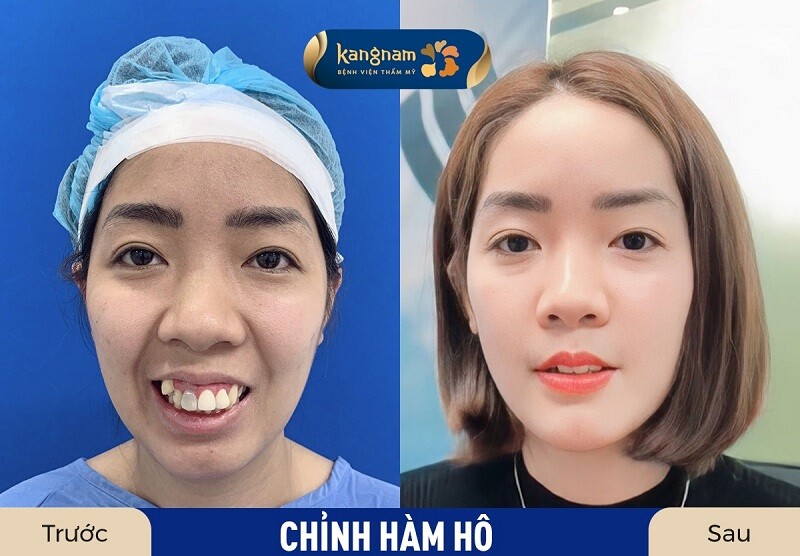 Tuân thủ hướng dẫn của bác sĩ để vết thương nhanh phục hồi