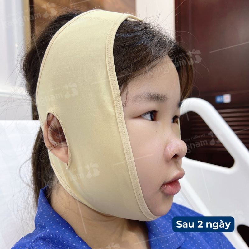 Cảm giác sưng và đau nhẹ thường xuất hiện sau phẫu thuật nhưng sẽ giảm dần sau vài ngày