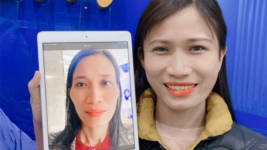 Độn thái dương có ảnh hưởng gì không? cần chú ý điều gì