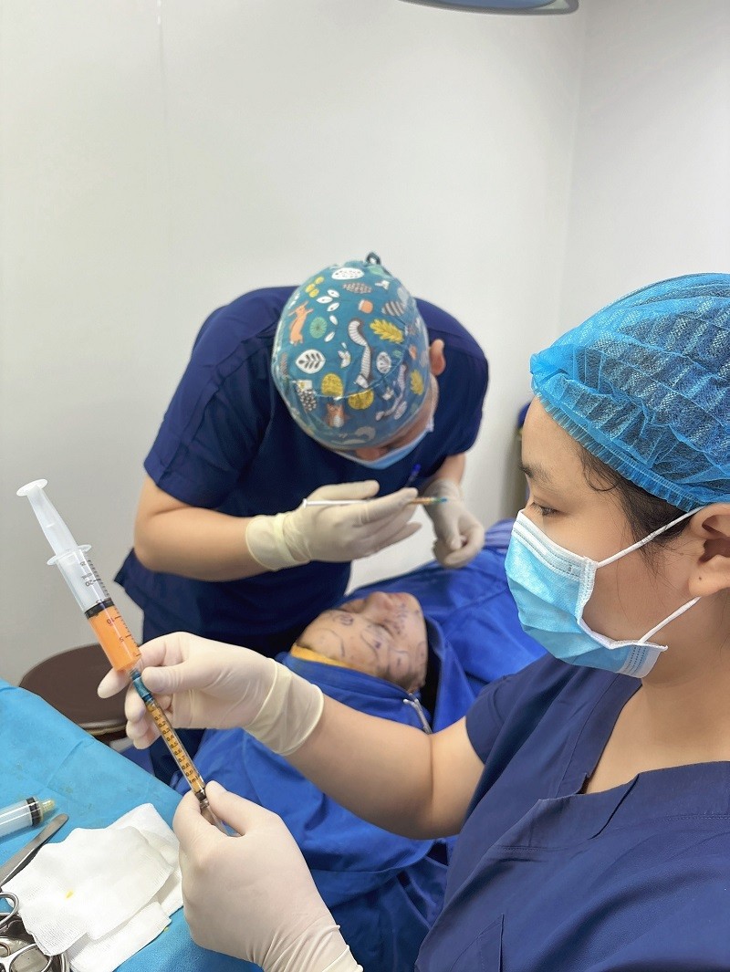 Cấy mỡ tự thân độn thái dương có độ tương thích cao với cơ thể