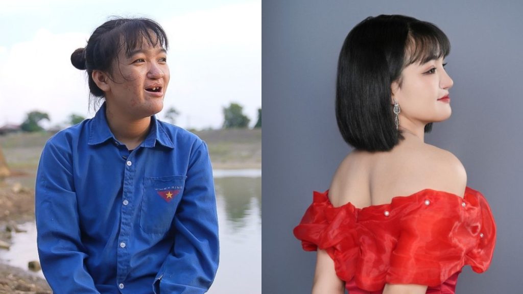 Hành trình Lột xác: Khi “phép màu” hiện hữu