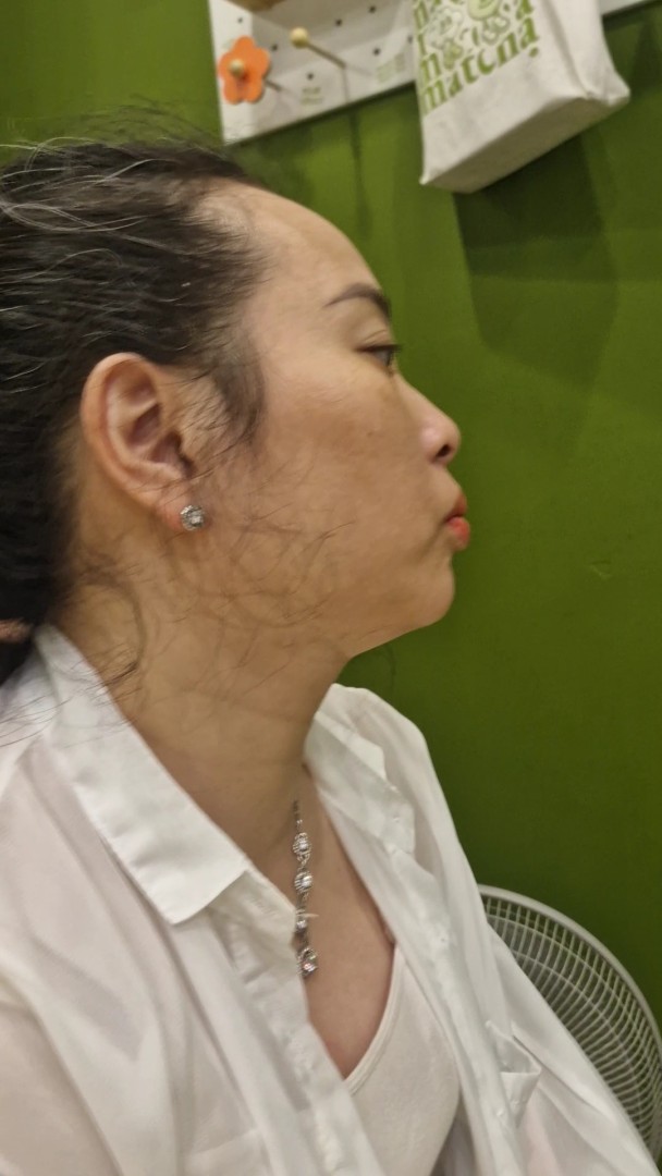 Nghiêng trái