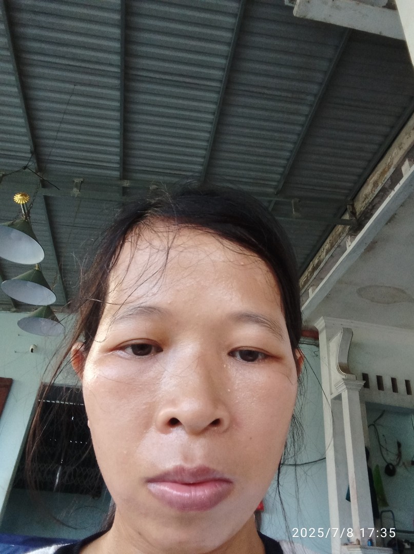 Toàn thân