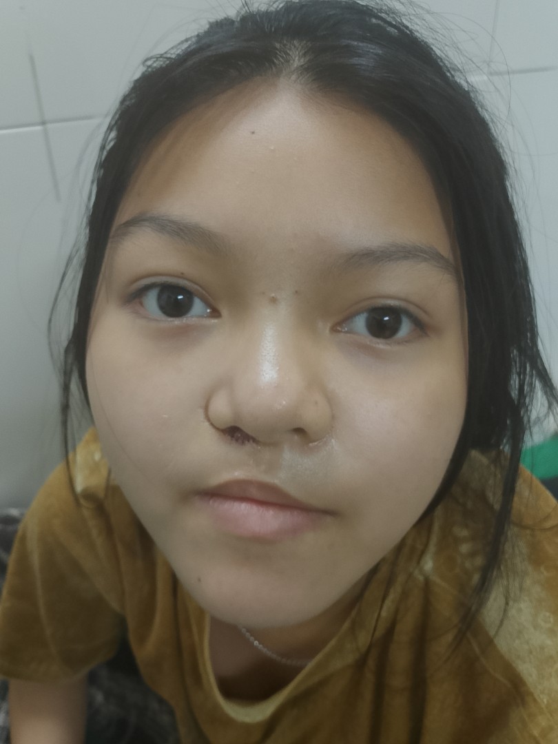 Ảnh lớn