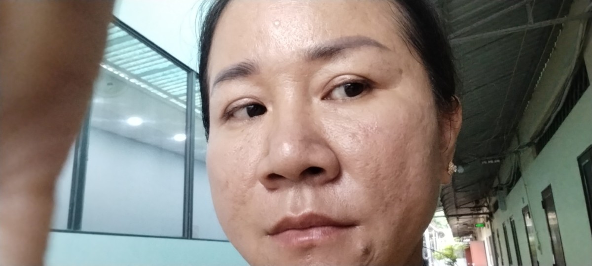 Toàn thân
