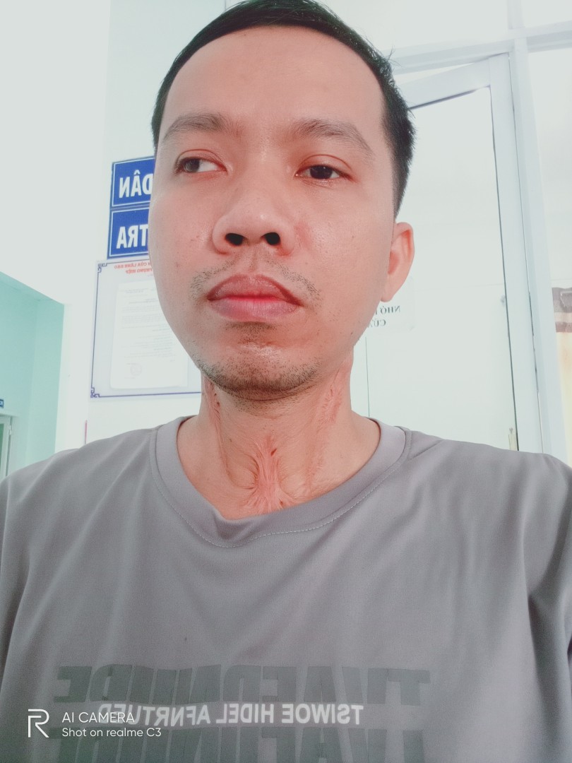 Ảnh lớn