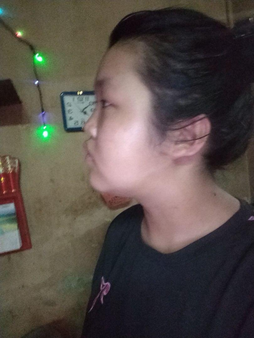 Toàn thân