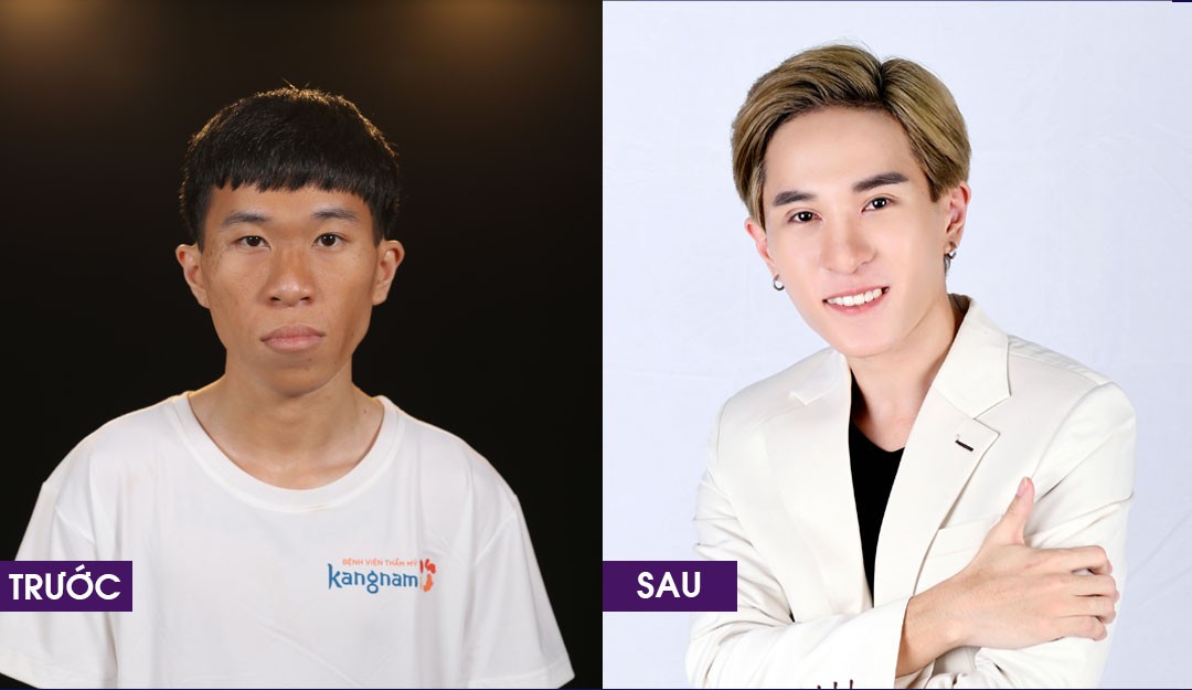 Thí sinh Trần Mạnh Cường trước và sau khi “lột xác”