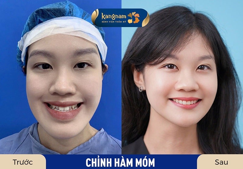 Bác sĩ phẫu thuật có kinh nghiệm sẽ giúp khách hàng khắc phục được khuyết điểm