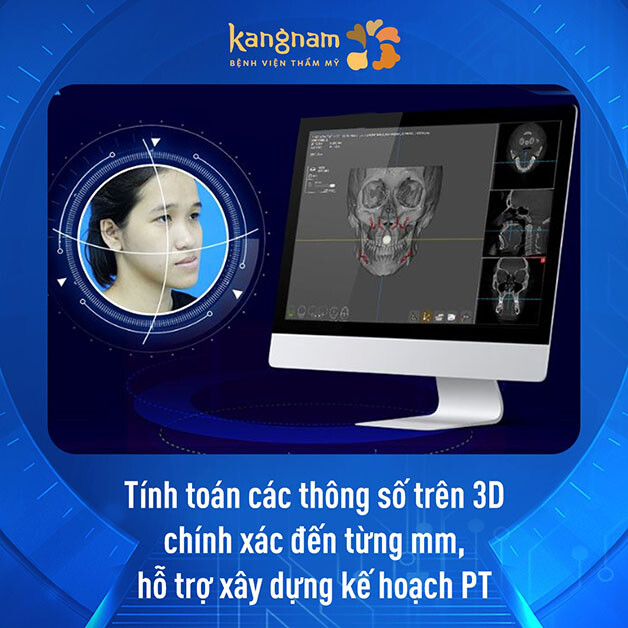 Kangnam ứng dụng công nghệ AI xem trước kết quả
