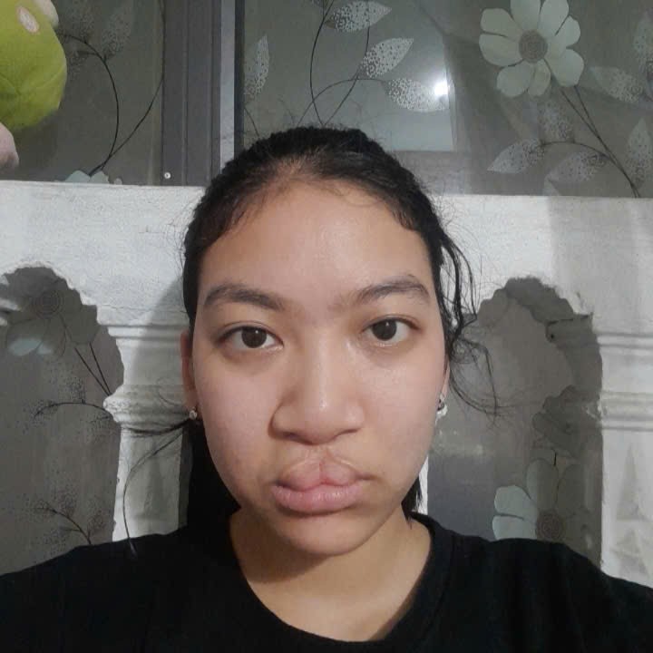 Ảnh lớn