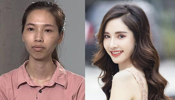 Phan Thị May lột xác ngoạn mục, trở thành đại sứ thương hiệu thẩm mỹ